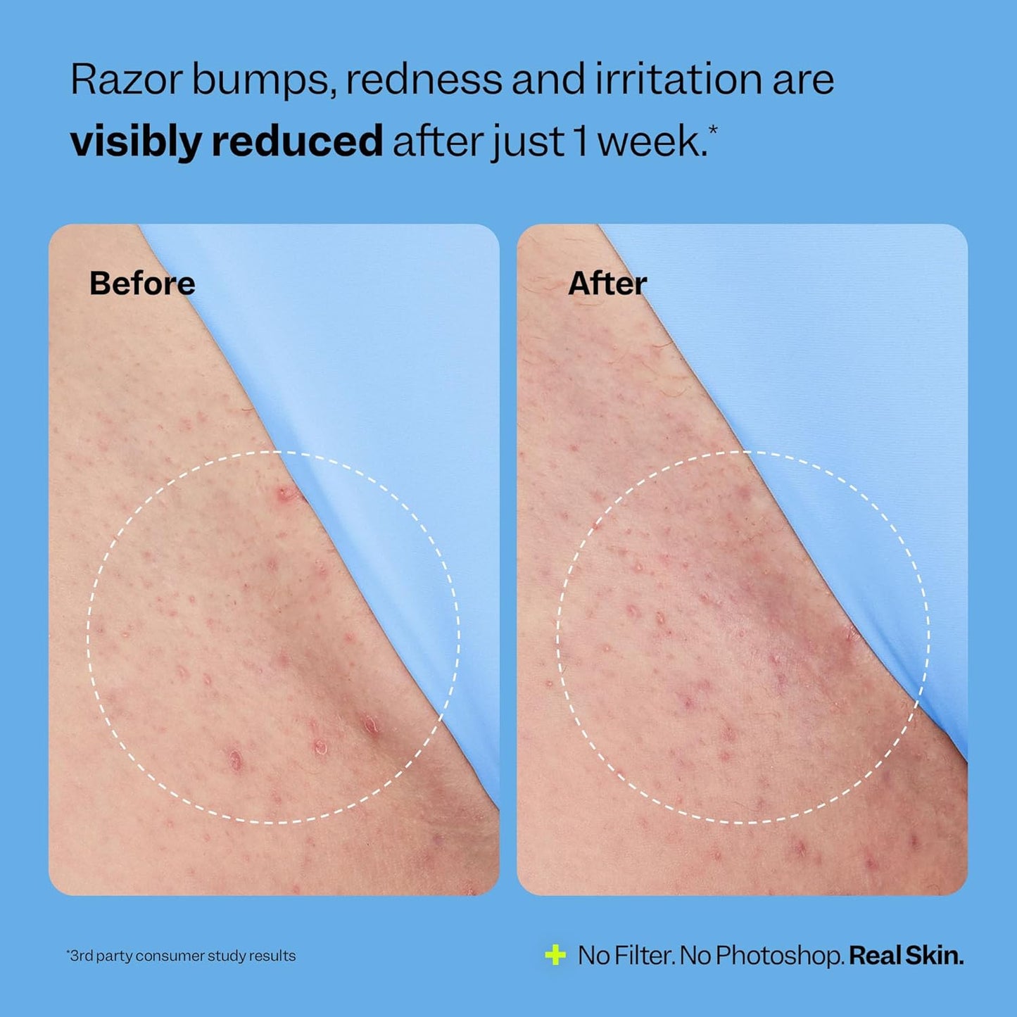 Peach Slices Smoothing Solution Ingrown Hair Treatment—XDX